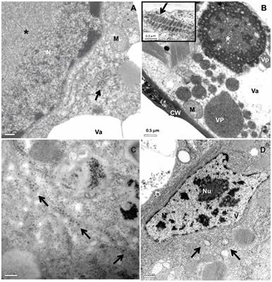 Circulative Transmission of Cileviruses in Brevipalpus Mites May Involve the Paracellular Movement of Virions